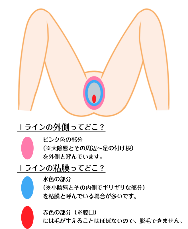 Iラインの詳しい脱毛範囲