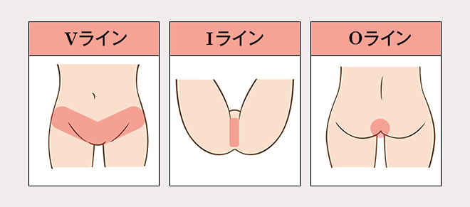 IラインとOラインの部位説明