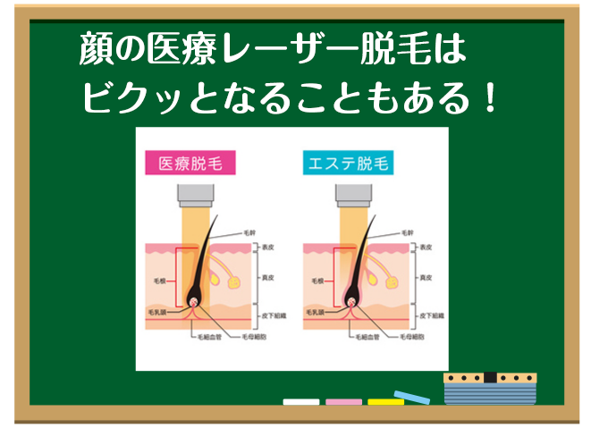 顔の医療レーザー脱毛