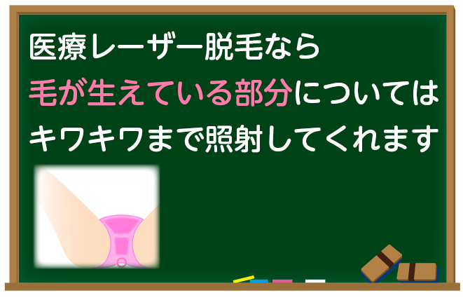 医療レーザー脱毛なら粘膜ギリギリまで対応可能