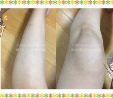 脚（ひざ上、ひざ下、ひざ）の画像