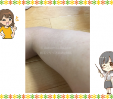 腕の画像