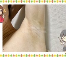 両ワキの画像