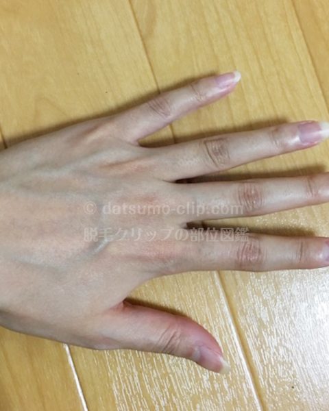 左手の甲と指の全体写真