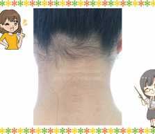 えりあし・うなじの画像
