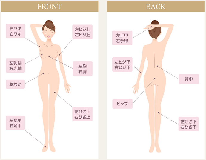 フレイアクリニックの全身脱毛対象範囲